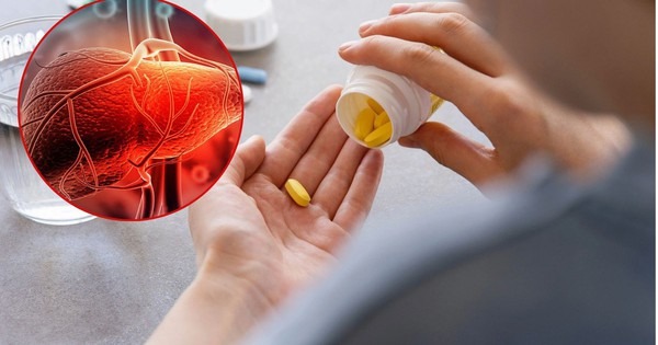 Dùng thuốc kiểu này, ‘phá gan’ chẳng khác gì uống 1 lít rượu mỗi ngày Dùng thuốc kiểu này, ‘phá gan’ chẳng khác gì uống 1 lít rượu mỗi ngày