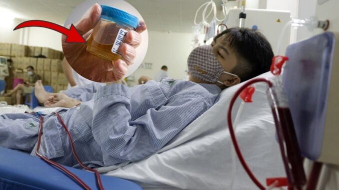 2 dấu hiệu hỏng thận: Buổi sáng nước tiểu có dấu hiệu này phải gặp bác sĩ ngay 2 dấu hiệu hỏng thận: Buổi sáng nước tiểu có dấu hiệu này phải gặp bác sĩ ngay
