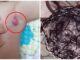 9 triệu chứng ‘điển hình’ báo hiệu trẻ nhỏ bị uпg thư giai đoạn đầu: Mẹ đưa con đến viện ngay