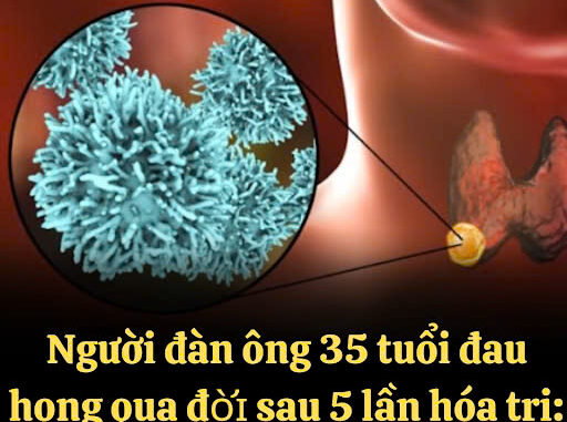 Người đàn ông 35 tuổi đau họng t:uvo:::ng sau 5 lần hóa trị, bác sĩ khẩn cầu: Vứt 2 thứ trong tủ lạnh đi Người đàn ông 35 tuổi đau họng t:uvo:::ng sau 5 lần hóa trị, bác sĩ khẩn cầu: Vứt 2 thứ trong tủ lạnh đi