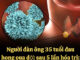 Người đàn ông 35 tuổi đau họng t:uvo:::ng sau 5 lần hóa trị, bác sĩ khẩn cầu: Vứt 2 thứ trong tủ lạnh đi
