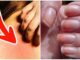 Ung thư ƌừng ƌể quá muộn: Bác sĩ Bệnh viện Việt Đức cảnh Ьáo 6 dấu hiệu không thể Ьỏ quɑ
