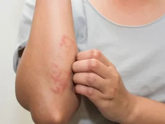 Ngứa ở 7 vị trí này là dấu hiệu cảnh báo khối u ác tính, có 1 cũng nên kiểm tra sức khỏe