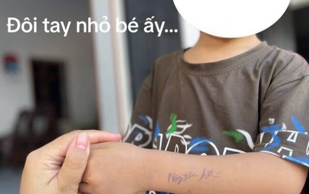 Dòng chữ kém duyên trên cánh tay học sinh mầm non do cô giáo viết khiến gia đình tức giận, mẹ Việt tranh cãi Dòng chữ kém duyên trên cánh tay học sinh mầm non do cô giáo viết khiến gia đình tức giận, mẹ Việt tranh cãi