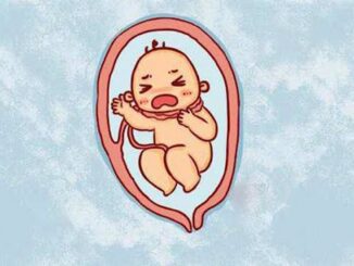 Dây rốn quấn cổ khi nào mẹ cần lo lắng