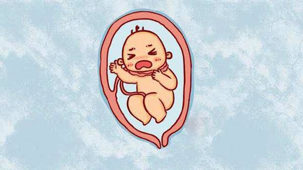 Dây rốn quấn cổ khi nào mẹ cần lo lắng Dây rốn quấn cổ khi nào mẹ cần lo lắng