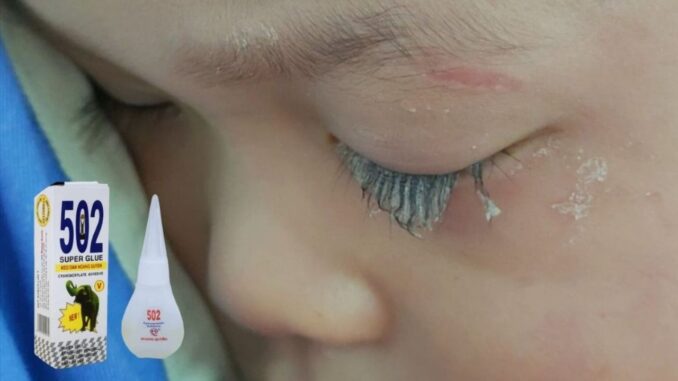 Bé trai 3 tuổi bị keo 502 bắn vào mắt, hành động của người mẹ trong “30 giây vàng” đã cứu con khỏi cảnh mù loà! Bé trai 3 tuổi bị keo 502 bắn vào mắt, hành động của người mẹ trong “30 giây vàng” đã cứu con khỏi cảnh mù loà!
