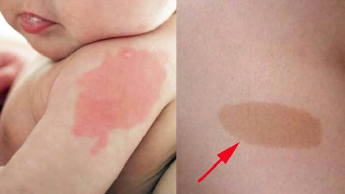 Đứa trẻ nào khi sinh ra hầu như đều có bớt trên người, nhưng nếu xuất hiện ở 10 vị trí sau báo hiệu số kiếp giàu sang Đứa trẻ nào khi sinh ra hầu như đều có bớt trên người, nhưng nếu xuất hiện ở 10 vị trí sau báo hiệu số kiếp giàu sang