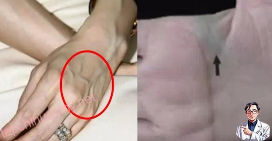Nhìn thấy ai có “gân xanh” nhất định phải nói cho họ biết điều này, vì sẽ cứu sống họ đấy Nhìn thấy ai có “gân xanh” nhất định phải nói cho họ biết điều này, vì sẽ cứu sống họ đấy
