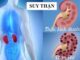 5 dấu hiệu suy thận giai đoạn đầu cần biết: Số 3 nhiều người bị nhưng phớt lờ