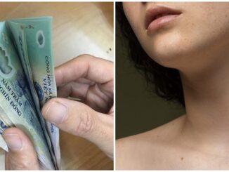 7 nốt ruồi là 'may mắn của kiếp người': Tuyệt đối đừng tẩy xóa