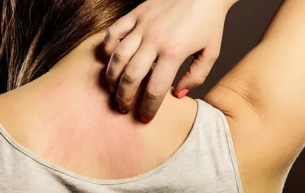 Cẩn thận: Ngứa 2 chỗ này trên cơ thể là biểu hiện của bệnh gan, đừng nhầm với dị ứng Cẩn thận: Ngứa 2 chỗ này trên cơ thể là biểu hiện của bệnh gan, đừng nhầm với dị ứng