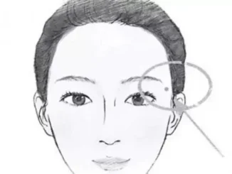 Điểm Mặt 5 Nốt Ruồi "Đế Vương" Càng Già Càng Giàu: Ai Có 1 Trong 5 Cũng Viên Mãn Cả Đời